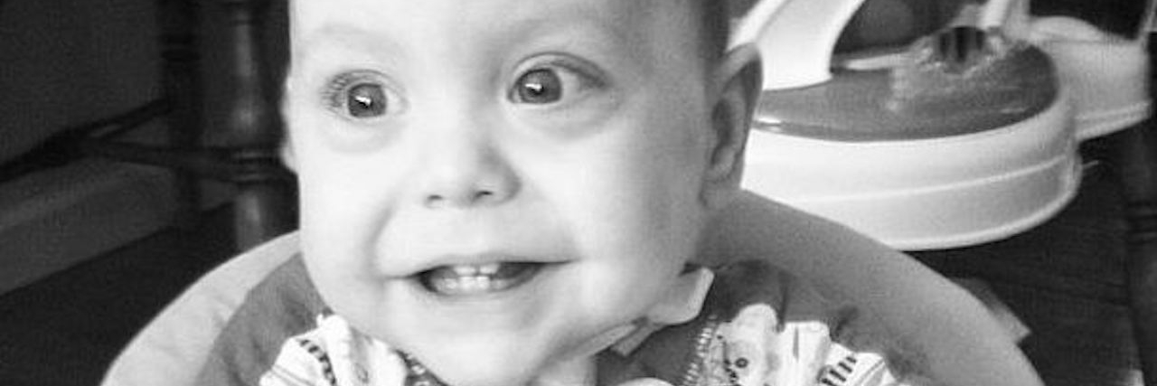 Prematurity: When Strangers See Past Young Boy's Health Conditions young boy smiling and sitting in a highchair