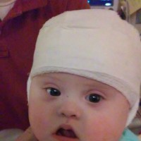 A small baby boy with his head bandaged.