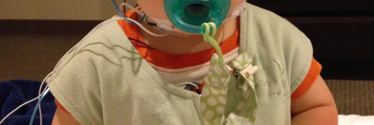 I Know You, Tracheomalacia baby with tracheomalacia