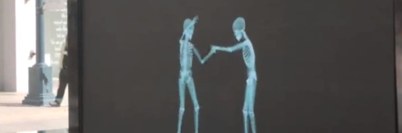 Love Has No Labels Ad Campaign Shows Love Has No Disability Image of two skeletons behind a black screen