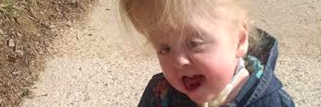 Peach's Neet Feet Gave My Daughter With Apert Syndrome Shoes and Hope Beth's daughter sitting outside