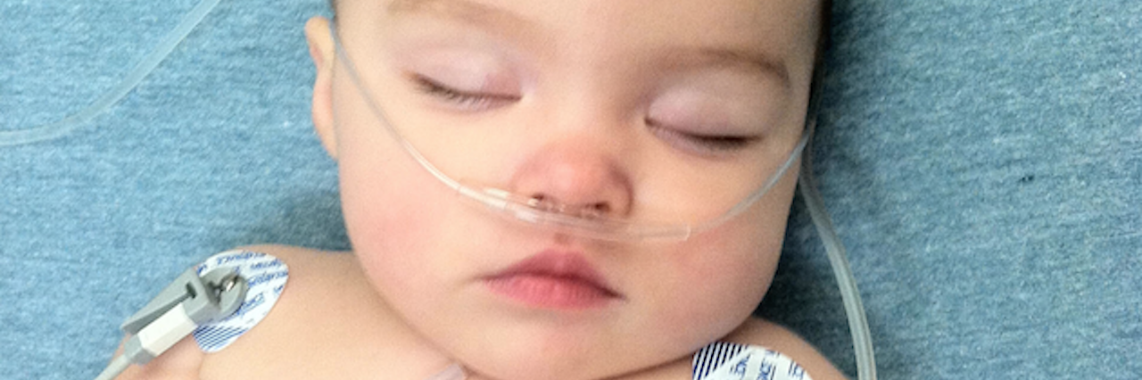 Life Lessons I Learned From My Daughter's Epilepsy baby girl hooked up to multiple wires and monitors