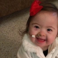 A small baby with Down syndrome smiling
