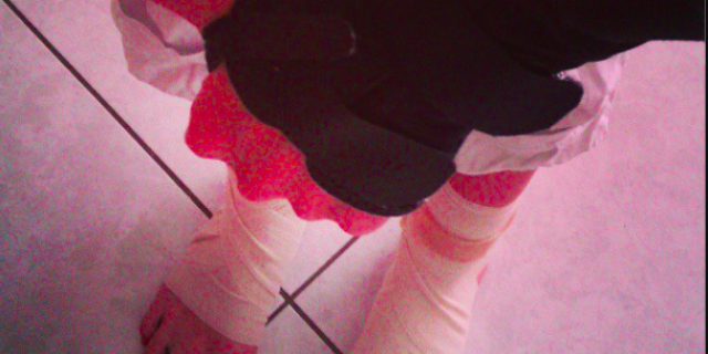 A Letter to My Juvenile Arthritis