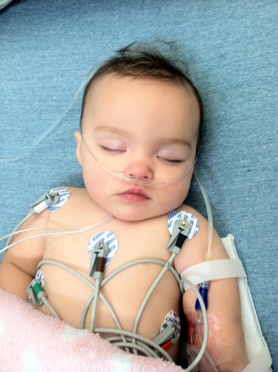 baby girl hooked up to multiple wires and monitors