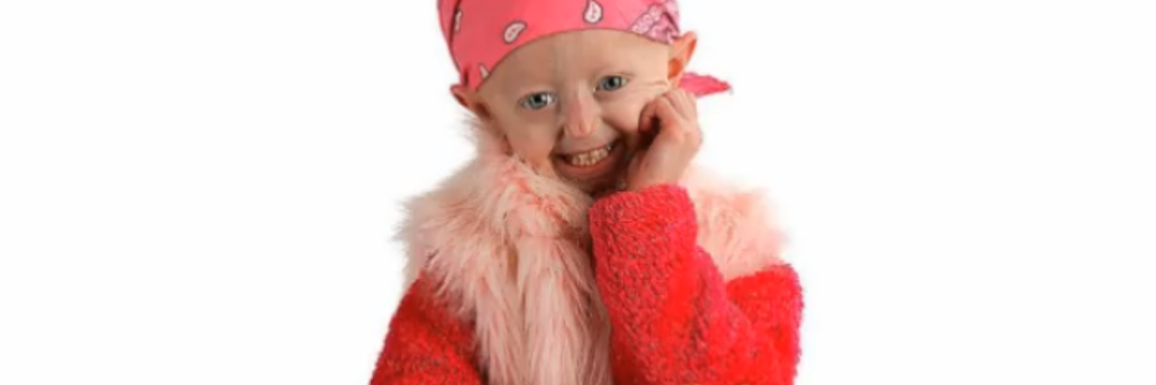 Hayley Okines, Teen Author With Rare Aging Condition, Dies at 17 hayley okines