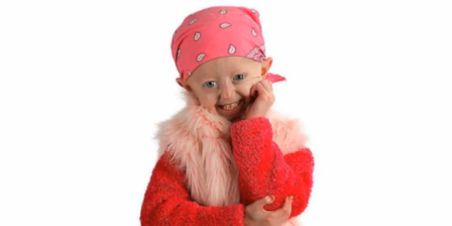 Hayley Okines, Teen Author With Rare Aging Condition, Dies at 17 hayley okines