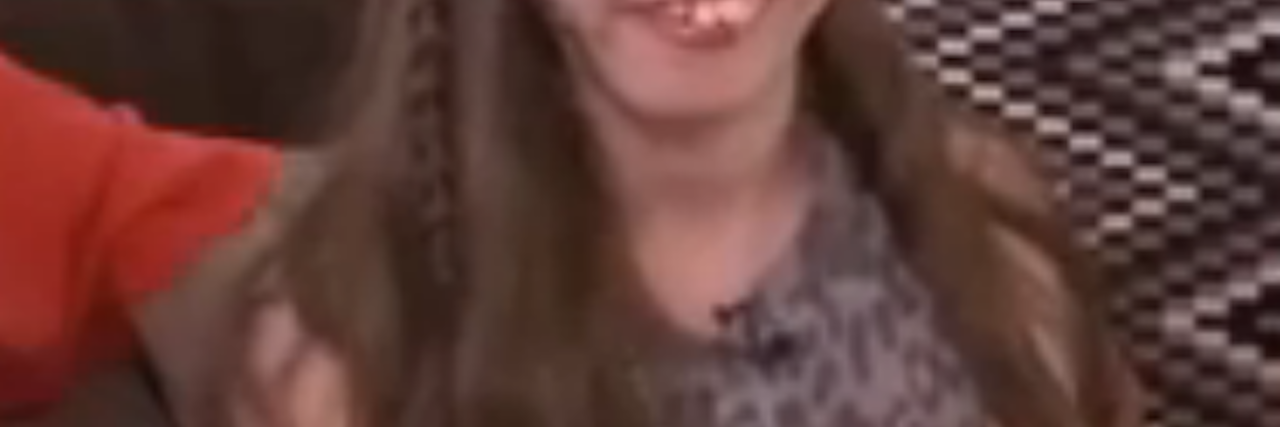 Strangers Steer Teen With Goldenhar Syndrome Away From Suicide