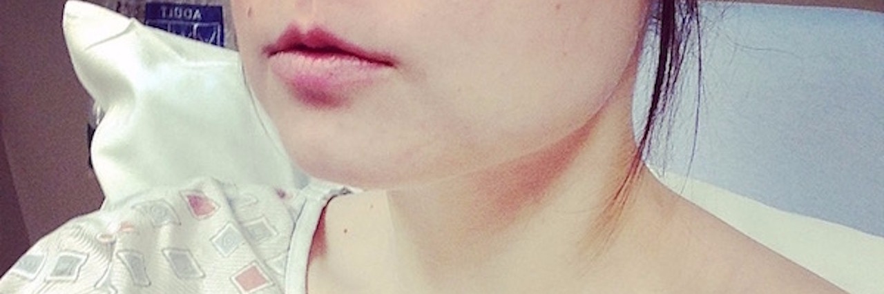 A Woman's Hurtful Response to My Systemic Scleroderma Chanel in a hospital gown