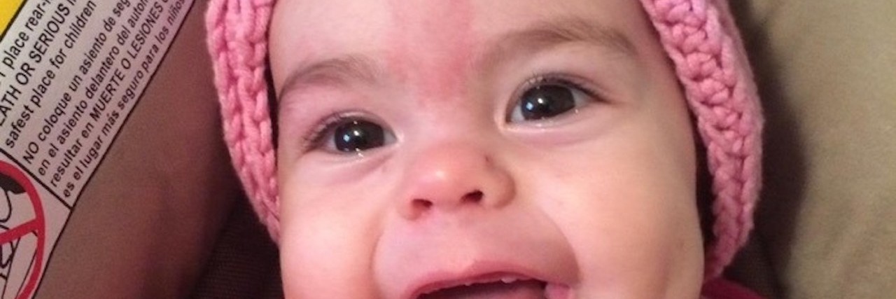 Laryngomalacia Won't Take Our Daughter's Laughter