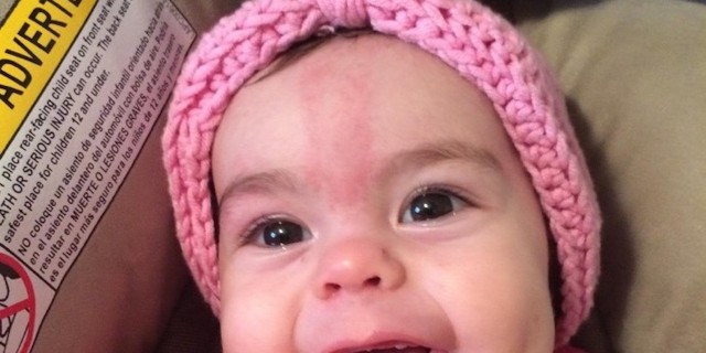 Laryngomalacia Won't Take Our Daughter's Laughter