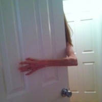Woman with scleroderma reaches her arm around a half-open door while her head and body are out of view.