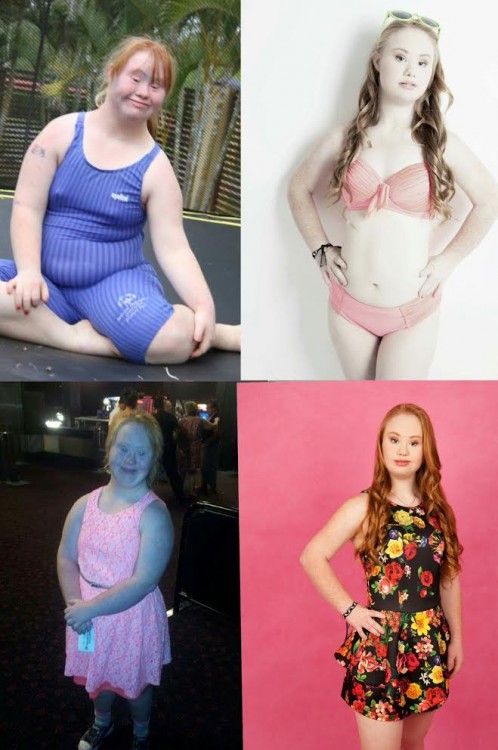 "Before and after" photos of Madelyn Stewart, showing her weight loss. 