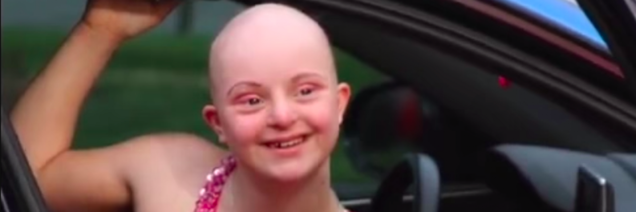 Young woman with bald head smiling while wearing a prom dress