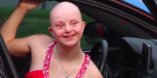 Young woman with bald head smiling while wearing a prom dress