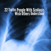 screen grab of x-ray photo with text that says 22 truths people with scoliosis wish others understood