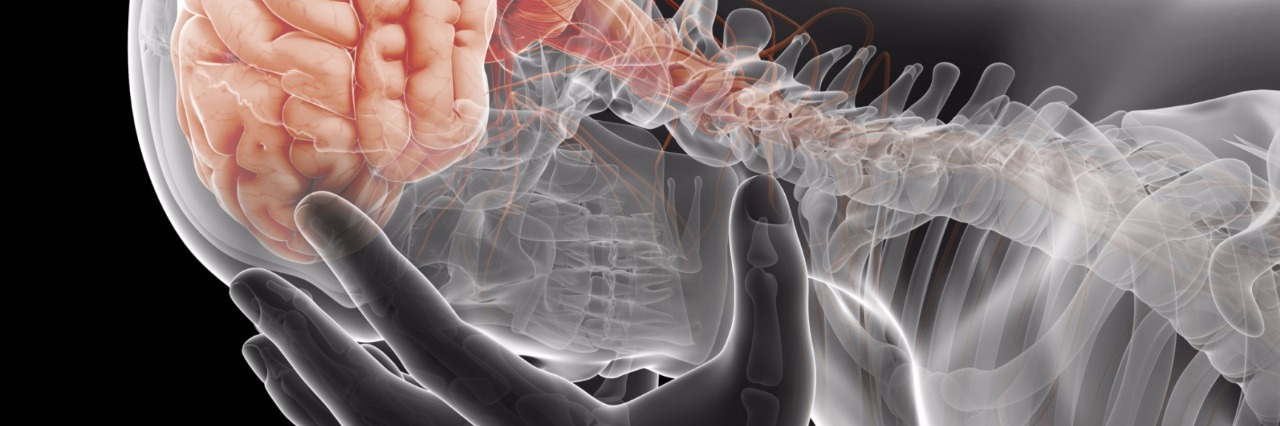 34 People Living With Migraines Explain What It's Like man with skeleton and brain exposed holding head