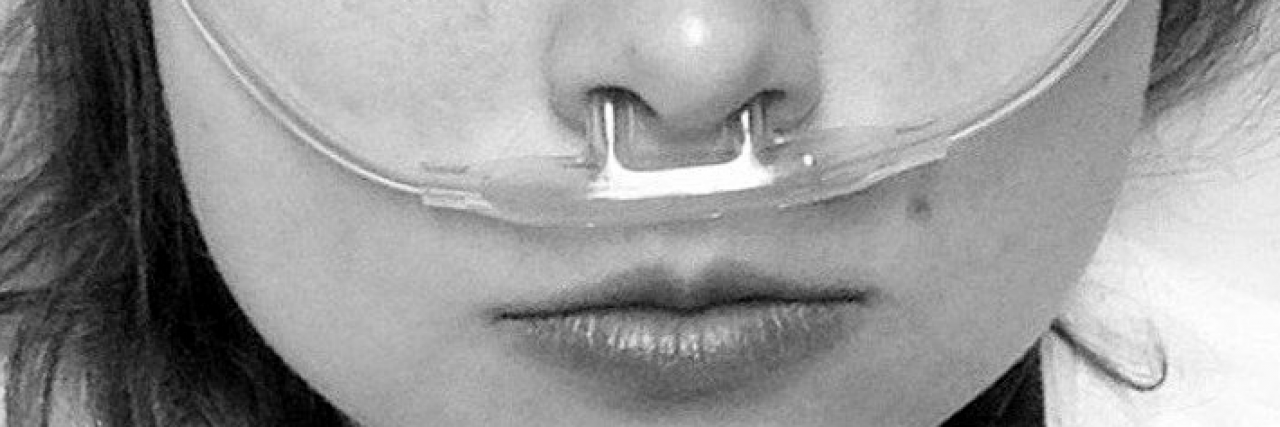 Woman With Scleroderma Responds to Being Called Lucky in ER black and white photo of young woman with breathing tubes
