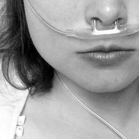 black and white photo of young woman with breathing tubes