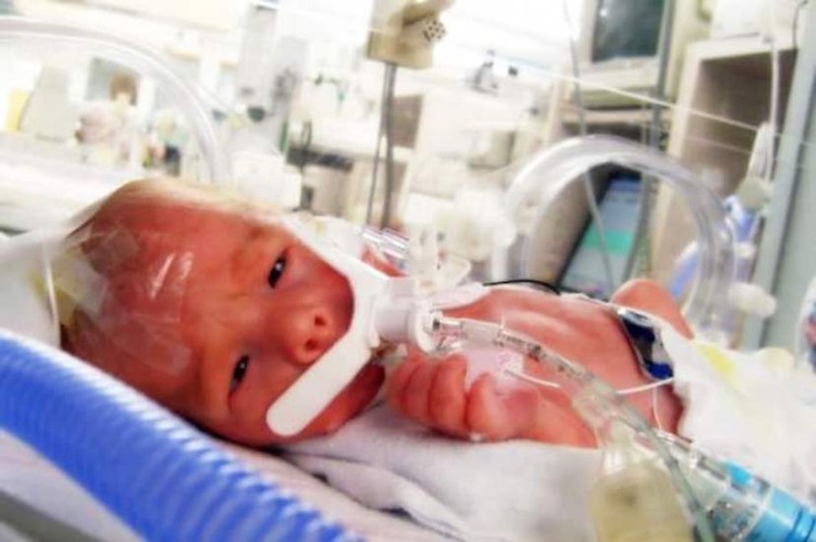 Baby with a breathing tube at the hospital.