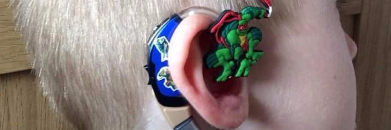 Mom Designs Lugs Hearing Aid Decorations For Kids colorful hearing aid decoration by Lugs