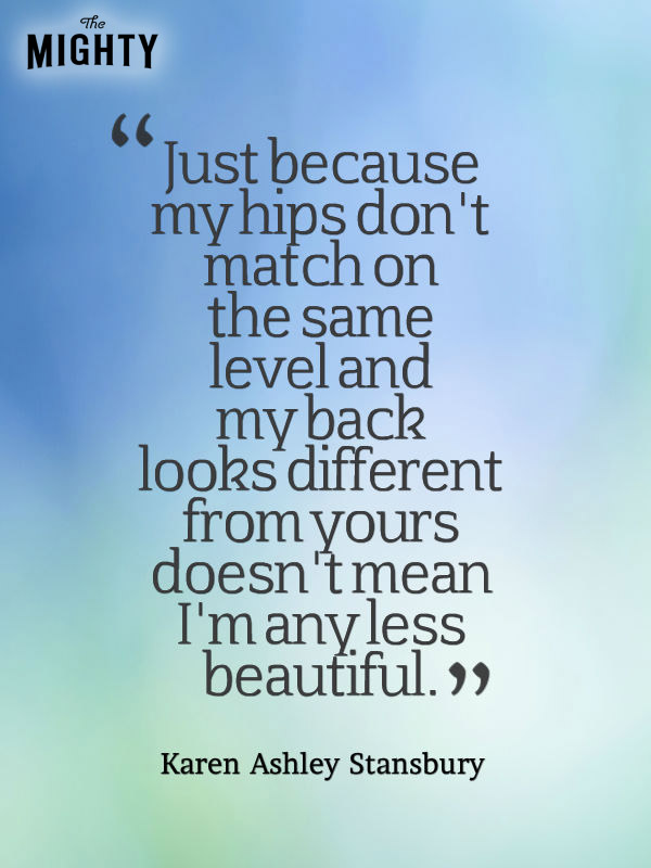 “Just because my hips don't match on the same level and my back looks different from yours doesn't mean I'm any less beautiful.” — Karen Ashley Stansbury