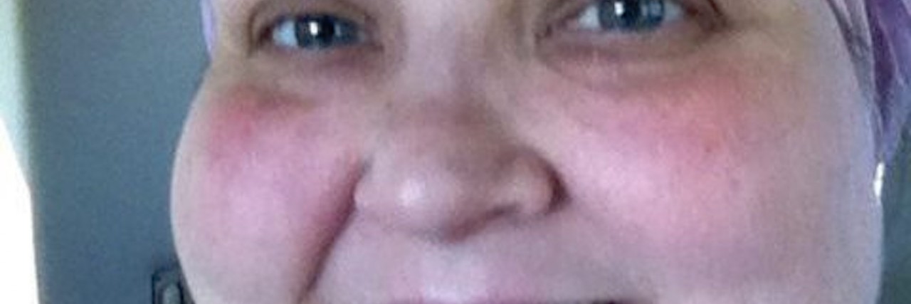 When a Boy in the Hospital Didn’t Judge Me for My Appearance