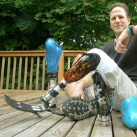 man poses with his prosthetic leg