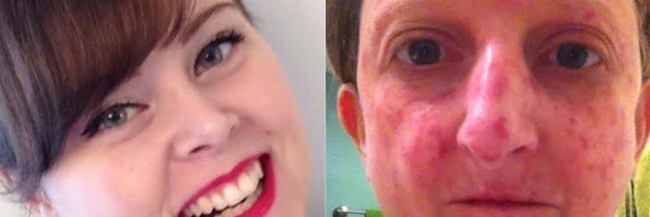 Don’t Judge People With Chronic Illness by Their Appearance