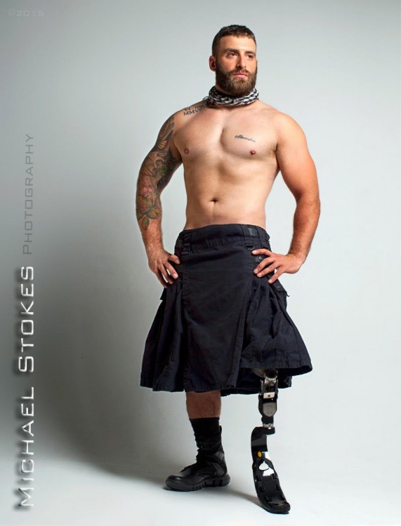 man with amputation wearing a kilt