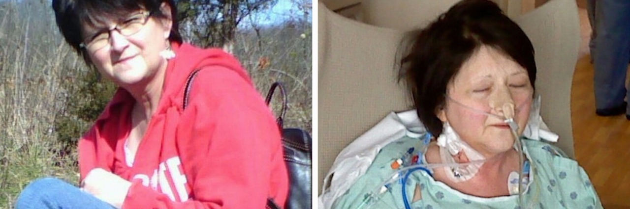 My Mother Spent 55 Years Chasing a Diagnosis of Pancreas Divisum photo of older woman sitting outside holding a dog next to photo of older woman in a hospital gown