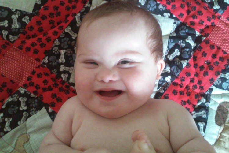 Baby with Down syndrome smiling. 