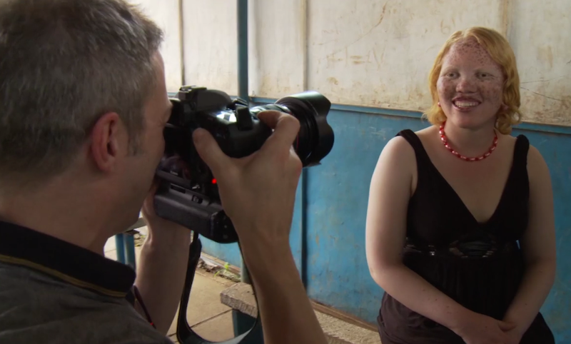 Guidotti photographs young woman with albinism