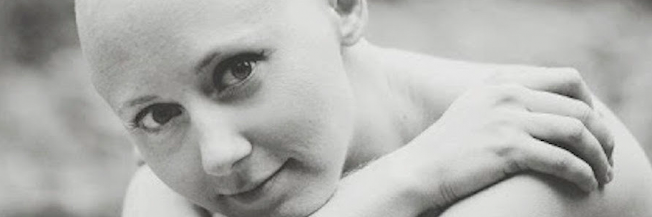 How I’m Showing the Side of Cancer That Brochures Leave Out