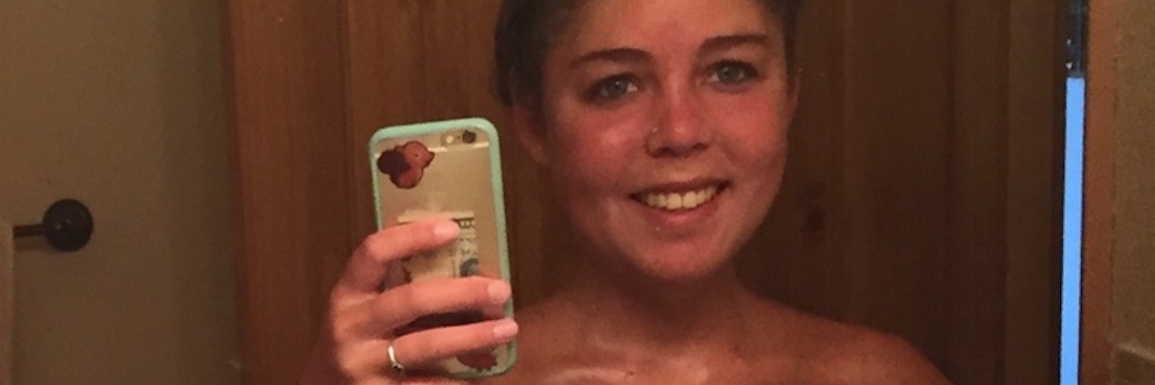 Gastroparesis: To the People Who Stare at My Tubes Woman holding phone and taking a selfie to show her feeding tubes