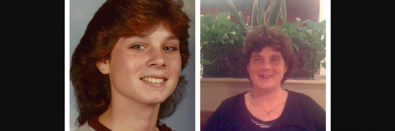 What We Can Learn From the Life and Death of My Sister With Schizophrenia