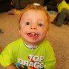 A small boy with a rare disorder smiles at camera