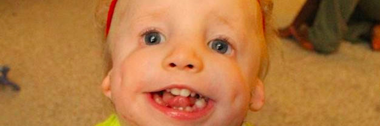 Treacher Collins Syndrome: A Letter to My Son Before His 11th Surgery A small boy with a rare disorder smiles at camera