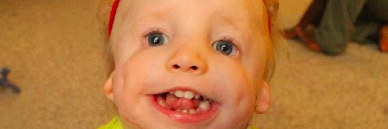 A small boy with a rare disorder smiles at camera