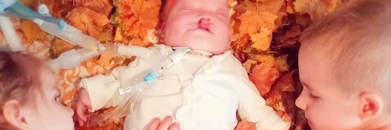 Benefits of Protecting an Immune-Fragile Child During Germ Season baby laying in fall leaves between two older siblings