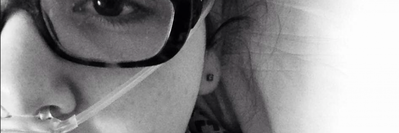 To the Nurses Who Accused Me of Faking My Seizures Close up of woman in hospital bed with breathing tube in nose