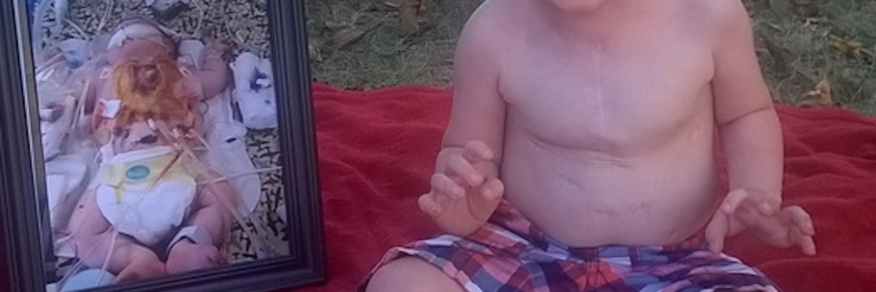 To the Doctor Who Urged Me to Abort My Child With a Heart Defect