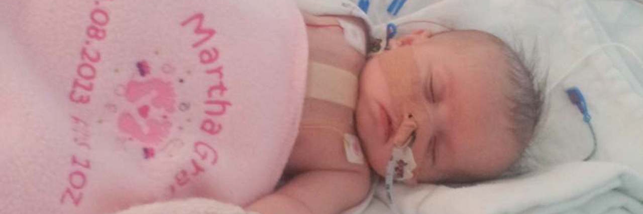 To the Mom Who Just Found Out Her Baby Has a Congenital Heart Defect