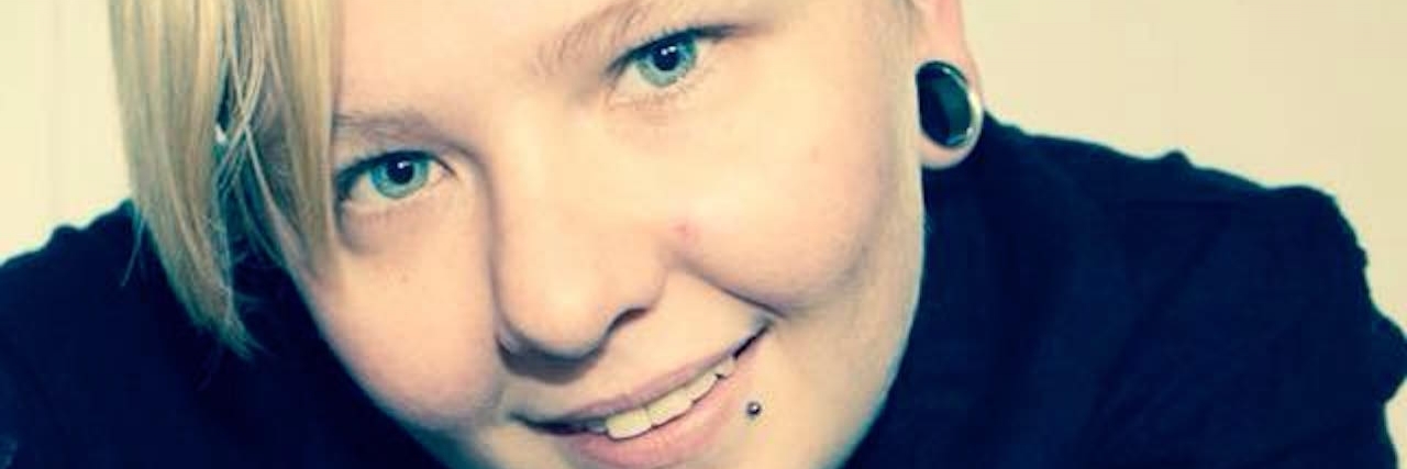 Jordan Supple's Photo Message to Teens Who Self-Harm