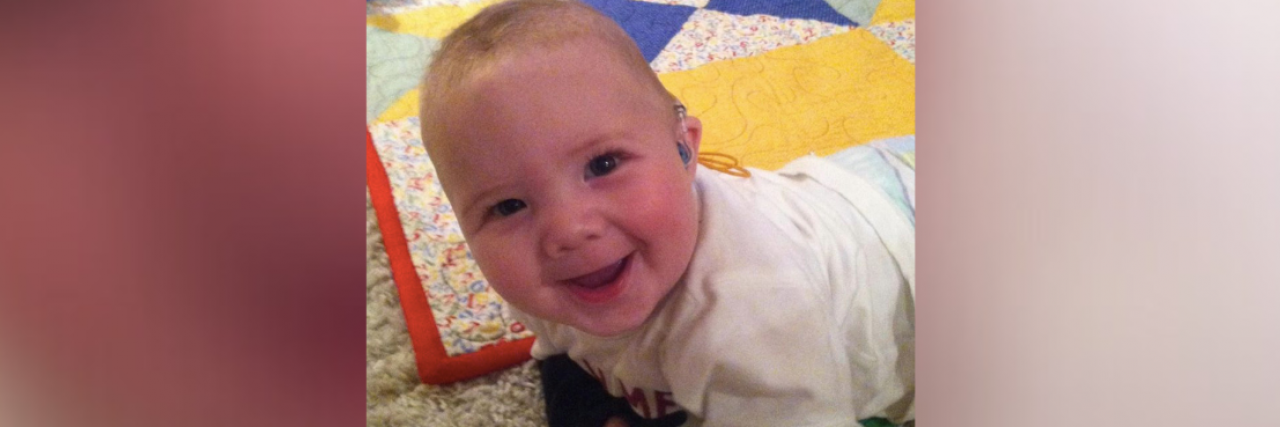 Grief and Parenting a Deaf Child Baby wearing a hearing aid and smiling