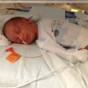 baby in the NICU with tubes, sleeping