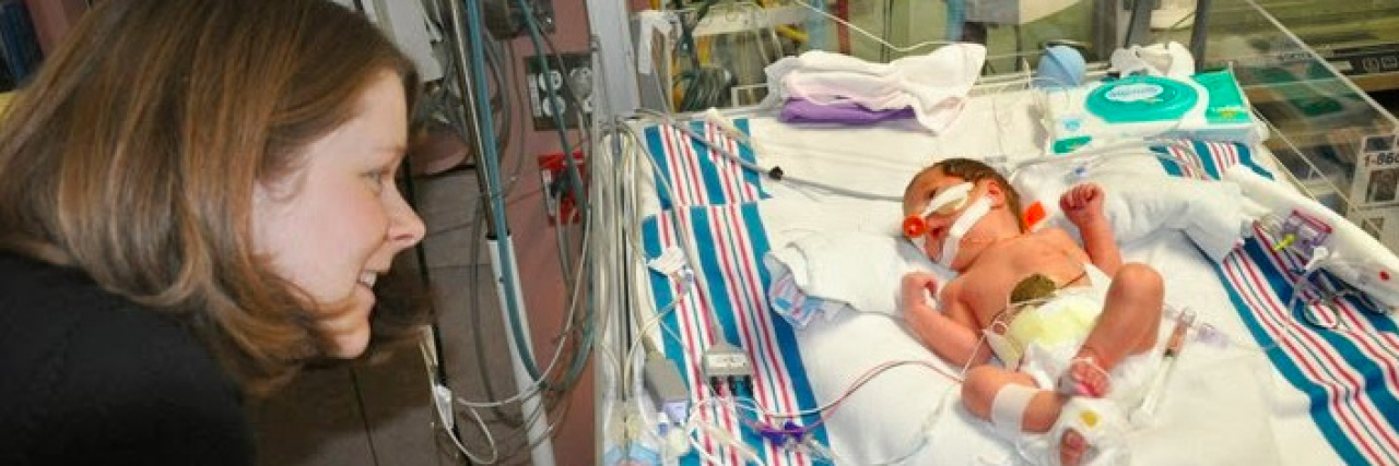 To the Doctors Who May Not Remember How You Talked About This Baby Woman looking at newborn baby in NICU