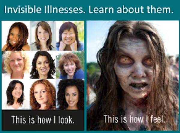 fibromyalgia meme: invisible illnesses. learn about them. this is how i look. this is how i feel.