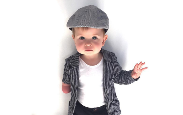 Fashion-Forward Toddler Born With One Arm Gets Instagram Famous | The ...