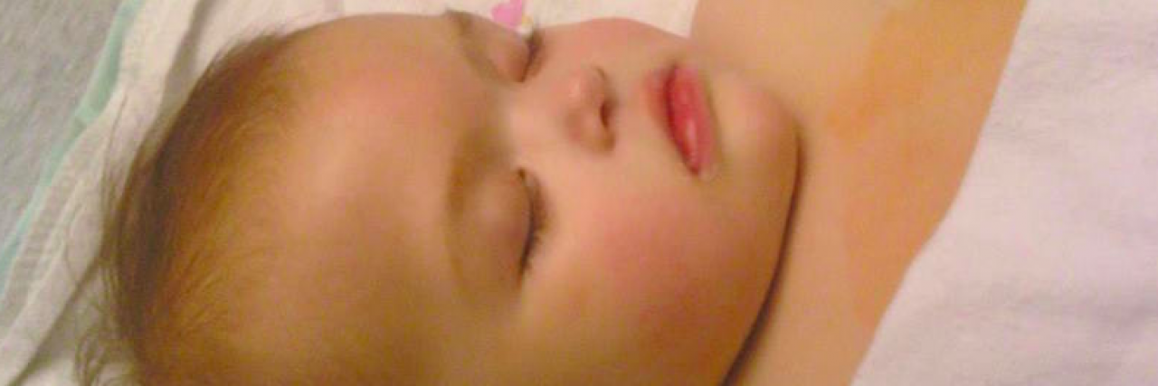 The Mental Health Toll of Parenting a Child With Cancer Contributor's baby in bed with eyes closed